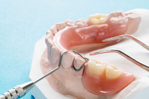 close up image of dental prosthetic symbolizing one of many denture solutions