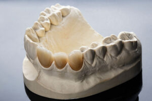 close up image of dental prosthetic of the lower jaw showcasing dental crowns