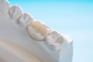 close up image of a dental crown as a reminder to practice aftercare essentials for your new dental crowns