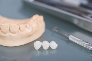 close up image of dental tools, and dental prosthetics as a model for discussing the ways of navigating the cost of implant-supported dental bridges